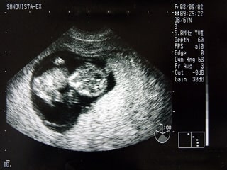 Medecine_Echographie-min