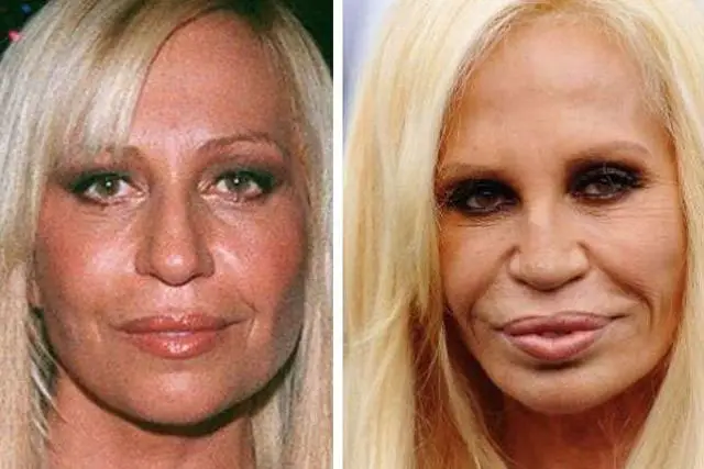 dontella versace-min