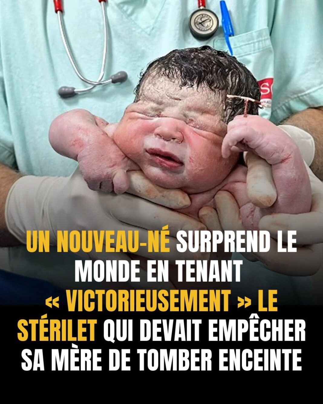 nouveau né et stérilet-min nouveau né et stérilet-min