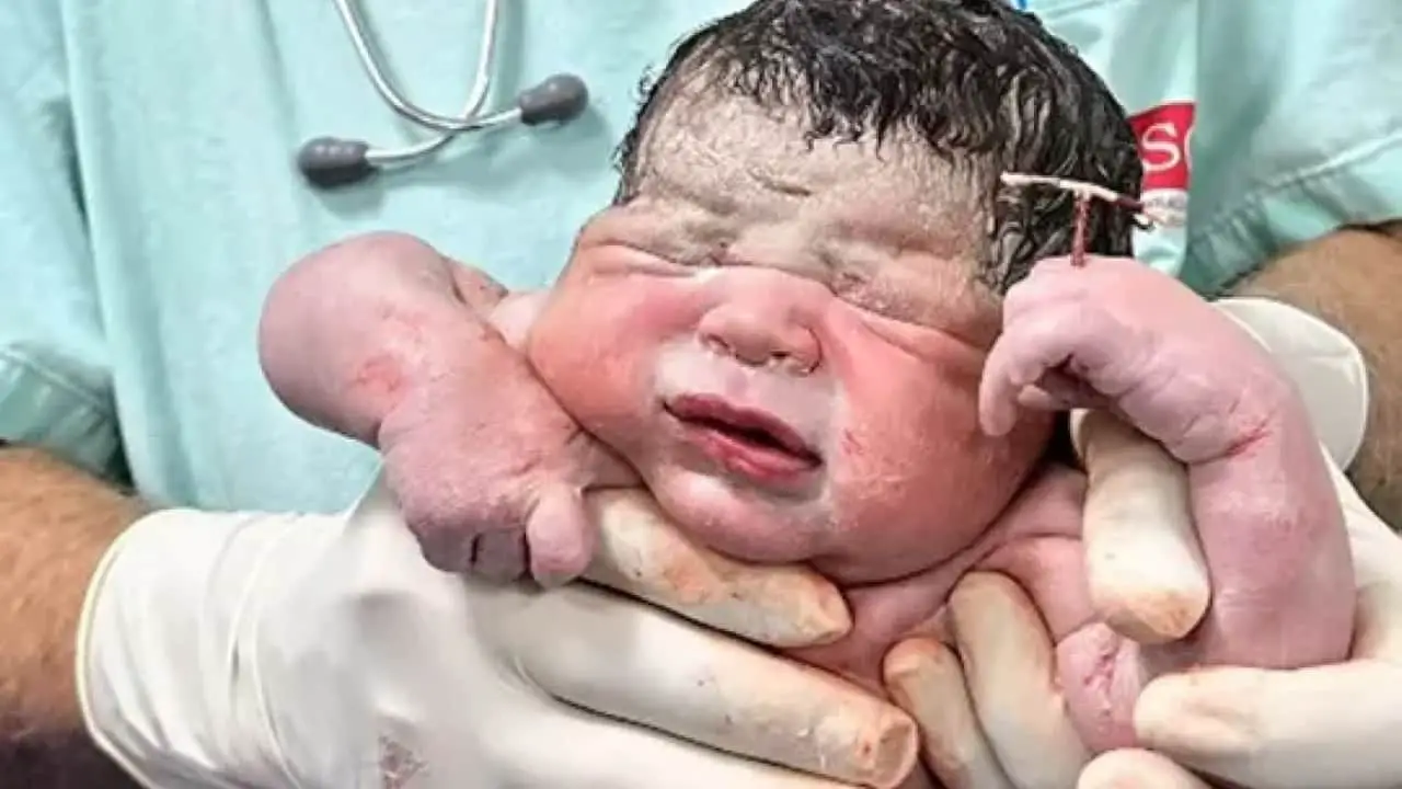 un bébé née avec stérilet-min