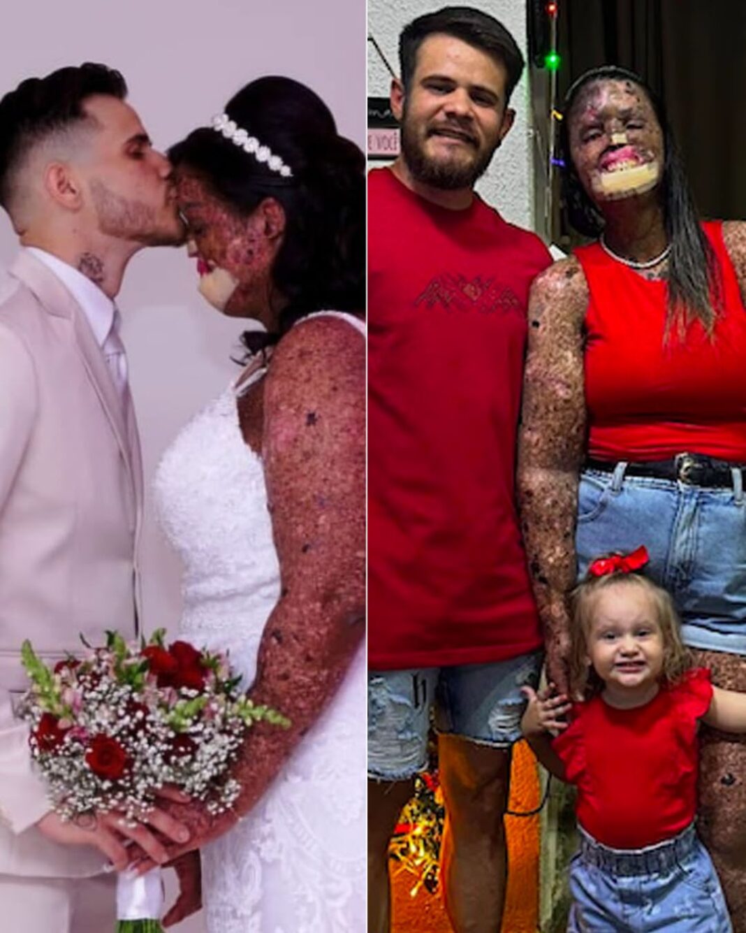 atteinte d'une maladie de peau-min