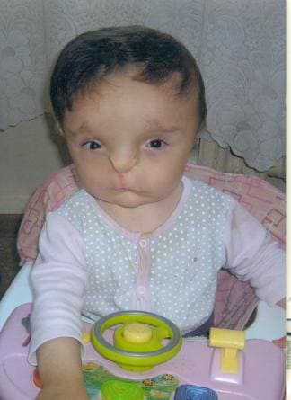 handicap
