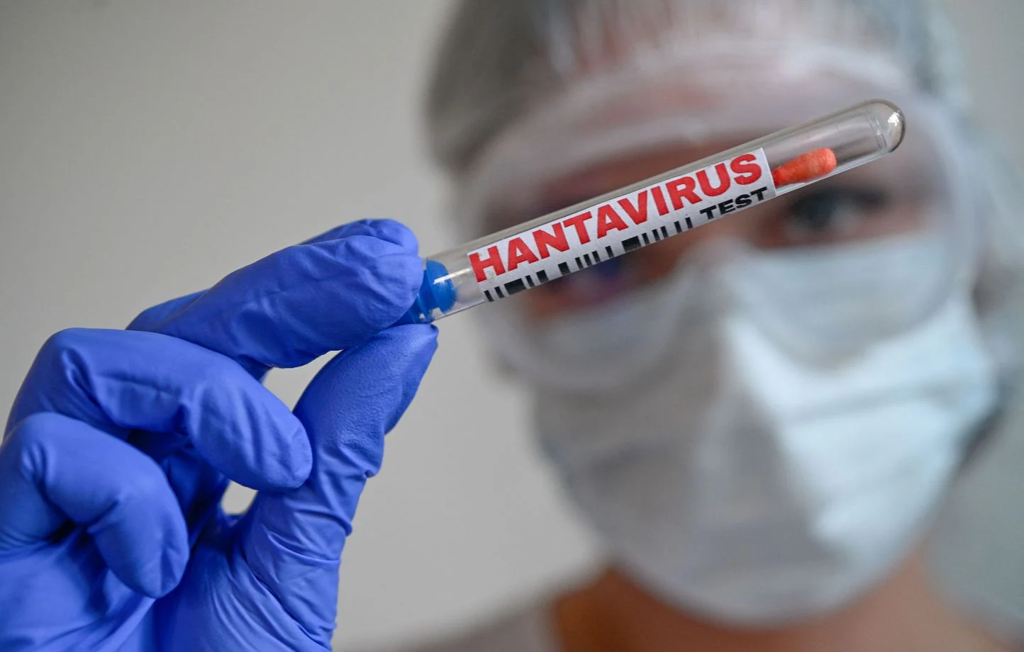 hantavirus