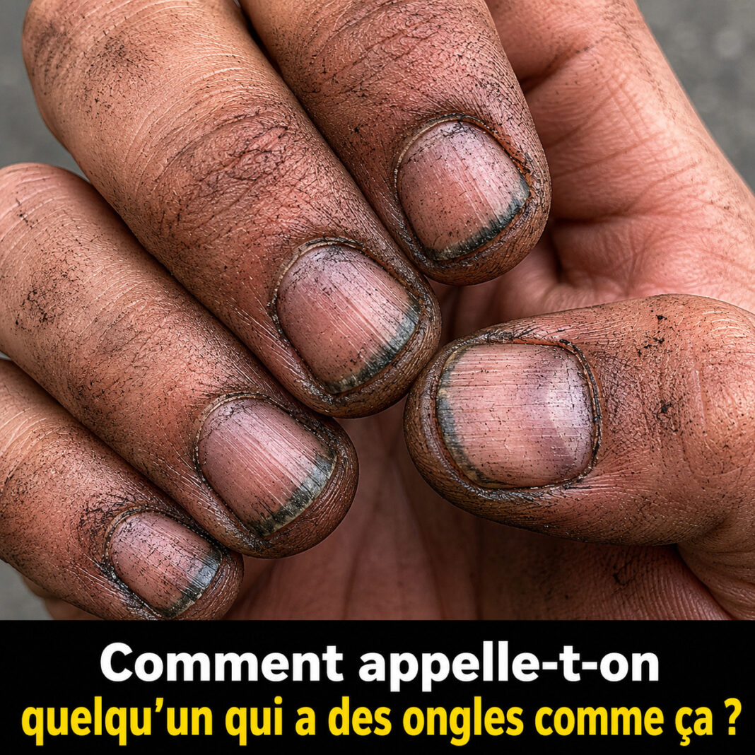 les ongles sales
